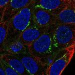 ARL15 Polyclonal Antibody