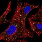 Arylsulfatase D Polyclonal Antibody