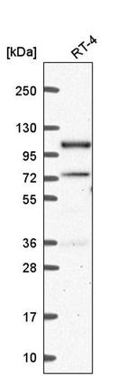 SMEK1 Antibody in Western Blot (WB)