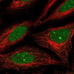 NUP188 Polyclonal Antibody