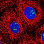 NOC3L Polyclonal Antibody