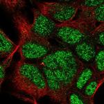 HOXC9 Antibody in Immunocytochemistry (ICC/IF)