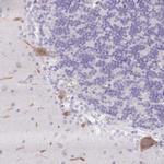 DCD Antibody in Immunohistochemistry (IHC)