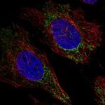 FAM160A2 Polyclonal Antibody