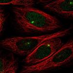 ZMYM1 Polyclonal Antibody