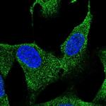 HS3ST3B1 Polyclonal Antibody