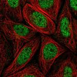 MED14 Polyclonal Antibody