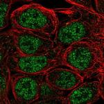 S100A5 Polyclonal Antibody