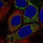 HKDC1 Polyclonal Antibody