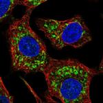 HKDC1 Polyclonal Antibody