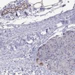 PTPRG Antibody in Immunohistochemistry (Paraffin) (IHC (P))