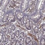 PTPRG Antibody in Immunohistochemistry (IHC)