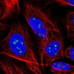 YY1AP1 Antibody in Immunocytochemistry (ICC/IF)