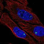ZDHHC4 Antibody in Immunocytochemistry (ICC/IF)