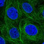 SH2D3A Polyclonal Antibody