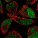 PPME1 Polyclonal Antibody