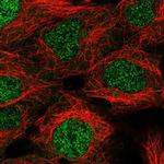 KDELC1 Polyclonal Antibody