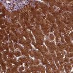 GOT1 Polyclonal Antibody