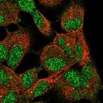 C3orf75 Polyclonal Antibody