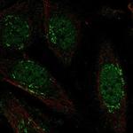 LRRC42 Polyclonal Antibody