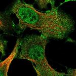 IFFO2 Polyclonal Antibody