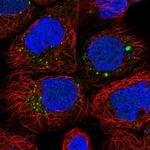 ANKRD6 Polyclonal Antibody