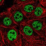 KIAA0196 Polyclonal Antibody