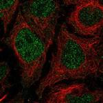 TMEM8A Polyclonal Antibody