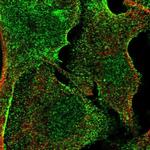 C20orf3 Polyclonal Antibody