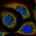 SLC44A1 Polyclonal Antibody