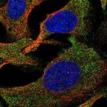 SLC35G2 Polyclonal Antibody