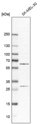 Asparagine Synthetase Antibody in Western Blot (WB)