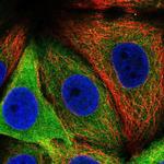 Asparagine Synthetase Polyclonal Antibody