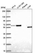 Asparagine Synthetase Antibody in Western Blot (WB)