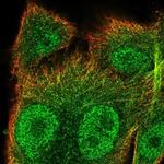 SNX10 Antibody in Immunocytochemistry (ICC/IF)