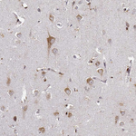 RNF13 Antibody in Immunohistochemistry (Paraffin) (IHC (P))