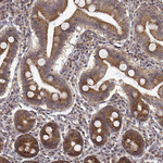 RNF13 Antibody in Immunohistochemistry (Paraffin) (IHC (P))