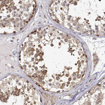 RNF13 Antibody in Immunohistochemistry (Paraffin) (IHC (P))