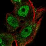 RNF13 Polyclonal Antibody