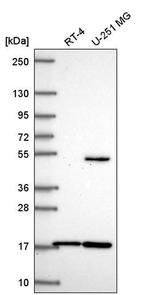 RNF13 Antibody in Western Blot (WB)