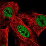 USP42 Polyclonal Antibody