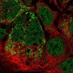 MRPL2 Polyclonal Antibody