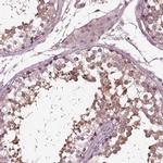 VWA5B1 Antibody in Immunohistochemistry (IHC)