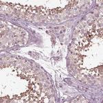 VWA5B1 Polyclonal Antibody