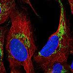 ATAD3A Polyclonal Antibody