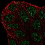 ABCA6 Polyclonal Antibody