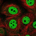 CSTF1 Polyclonal Antibody