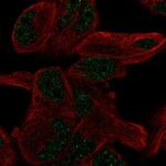 PGBD5 Polyclonal Antibody