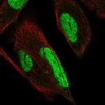PKNOX1 Polyclonal Antibody