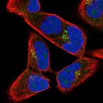 JAKMIP2 Polyclonal Antibody